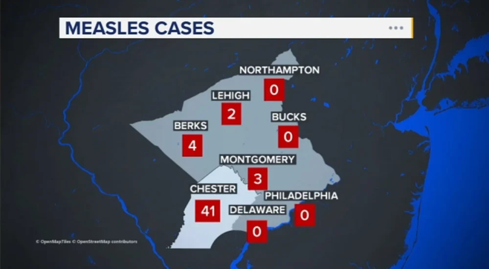 Pennsylvania Reports First Measles Deaths in Decades as State Health Officials Warn of Severe Illness Amid 2025 U.S. Surge and Rising Cases
