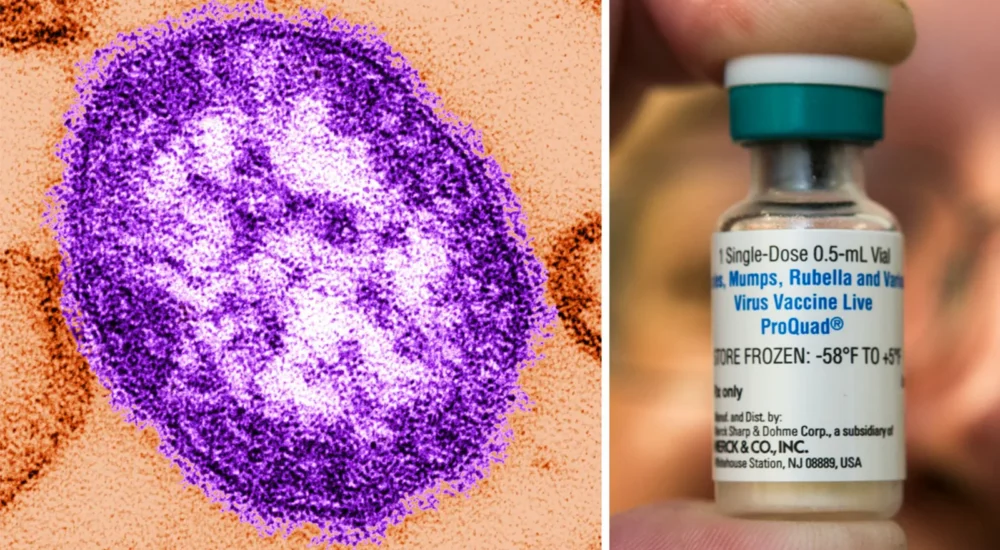 North Carolina Health Officials Warn of Possible Measles Exposure at Asheville Holiday Inn Express After Infectious Traveler Passed Through Buncombe County